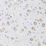 Immunohistochemistry - Anti-LC3B Antibody (A80596) - Antibodies.com