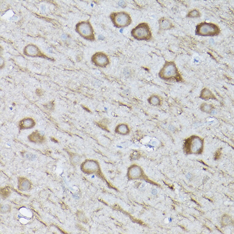 Immunohistochemistry - Anti-LC3B Antibody (A80596) - Antibodies.com