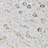 Immunohistochemistry - Anti-LC3B Antibody (A80596) - Antibodies.com