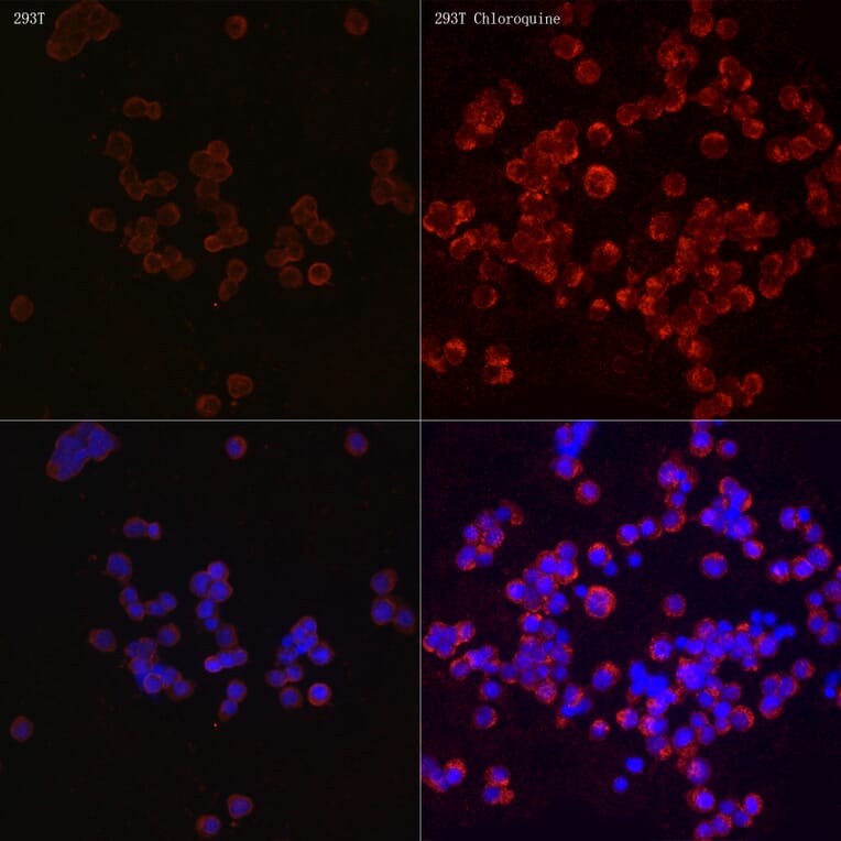 Immunofluorescence - Anti-LC3B Antibody (A80596) - Antibodies.com