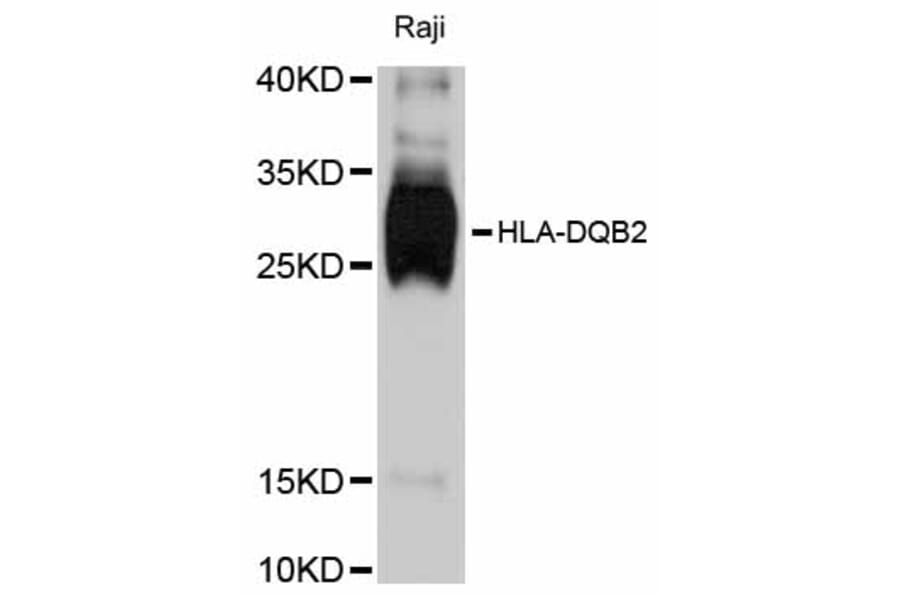 Western Blot - Anti-HLA-DQB2 Antibody (A11605) - Antibodies.com