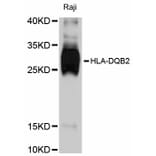 Western Blot - Anti-HLA-DQB2 Antibody (A11605) - Antibodies.com
