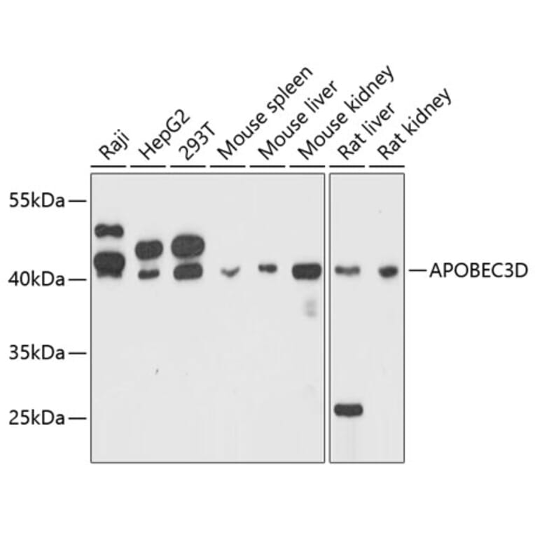 Western Blot - Anti-APOBEC3D Antibody (A80599) - Antibodies.com