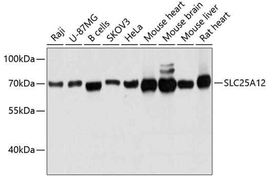 Western blot analysis of extracts of various cell lines, using Anti-SLC25A12 Antibody (A11688) at 1:3000 dilution.
Secondary antibody: Goat Anti-Rabbit IgG (H+L) (HRP) (AS014) at 1:10,000 dilution.
Lysates / proteins: 25µg per lane.
Blocking buffer: 3% non-fat dry milk in TBST.
Detection: ECL Basic Kit (RM00020).
Exposure time: 1s.