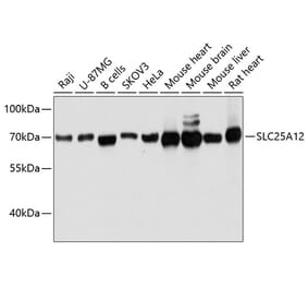 Western Blot - Anti-SLC25A12 Antibody (A80601) - Antibodies.com