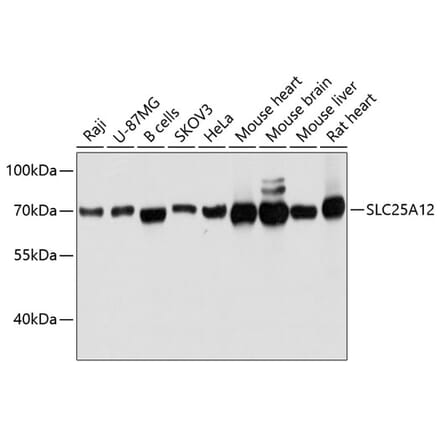 Western Blot - Anti-SLC25A12 Antibody (A80601) - Antibodies.com