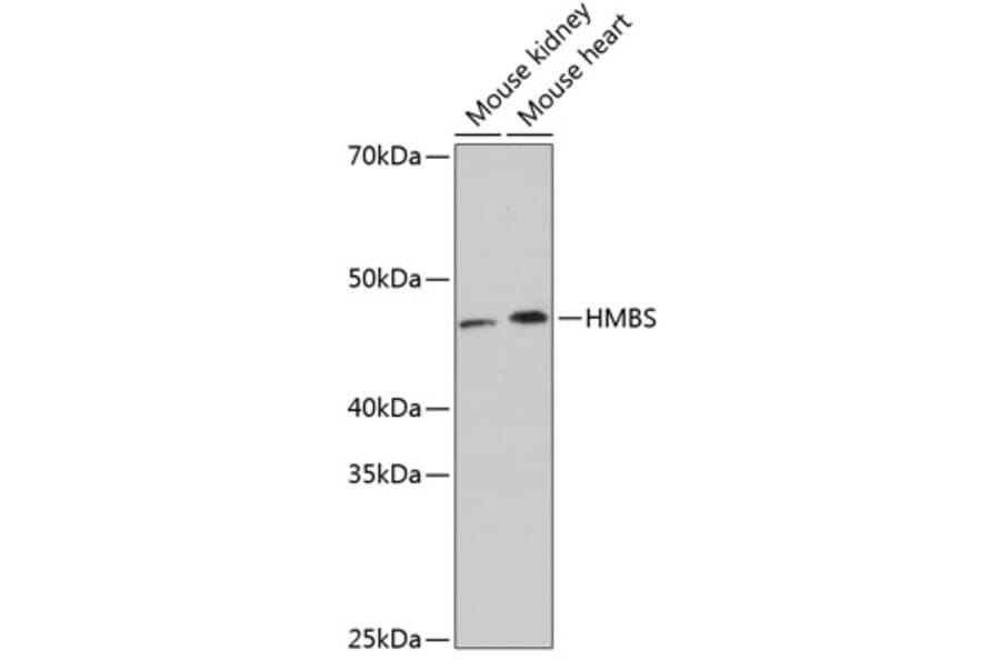 Western Blot - Anti-HMBS/PBGD Antibody [ARC0685] (A80602) - Antibodies.com