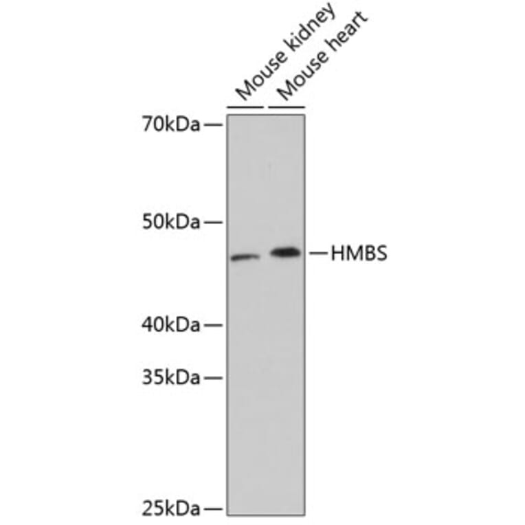 Western Blot - Anti-HMBS/PBGD Antibody [ARC0685] (A80602) - Antibodies.com