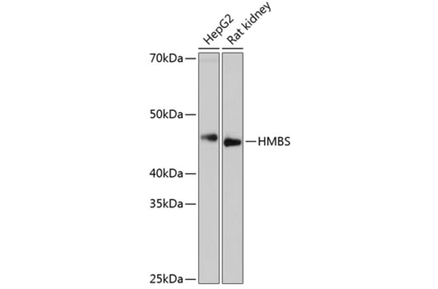 Western Blot - Anti-HMBS/PBGD Antibody [ARC0685] (A80602) - Antibodies.com