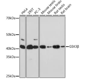 Western Blot - Anti-GSK3 beta Antibody [ARC0251] (A80603) - Antibodies.com