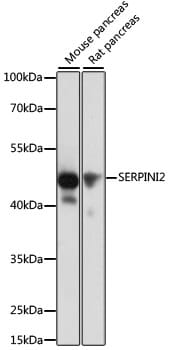 Western blot analysis of extracts of various cell lines, using Anti-SERPINI2 Antibody (A11732) at 1:1,000 dilution.
Secondary antibody: Goat Anti-Rabbit IgG (H+L) (HRP) (AS014) at 1:10,000 dilution.
Lysates / proteins: 25µg per lane.
Blocking buffer: 3% non-fat dry milk in TBST.
Detection: ECL Basic Kit (RM00020).
Exposure time: 10s.
