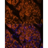 Immunofluorescence - Anti-SERPINI2 Antibody (A80604) - Antibodies.com