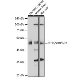 Western Blot - Anti-PEDF Antibody (A80606) - Antibodies.com