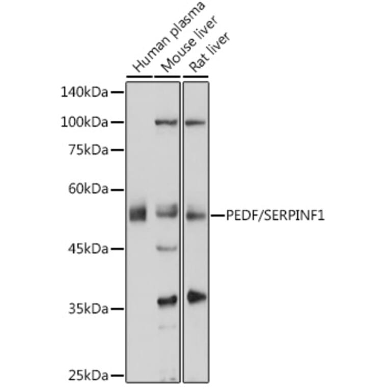 Western Blot - Anti-PEDF Antibody (A80606) - Antibodies.com