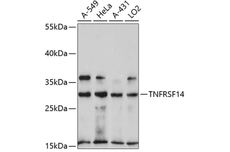 Western Blot - Anti-TNFRSF14 Antibody (A11832) - Antibodies.com