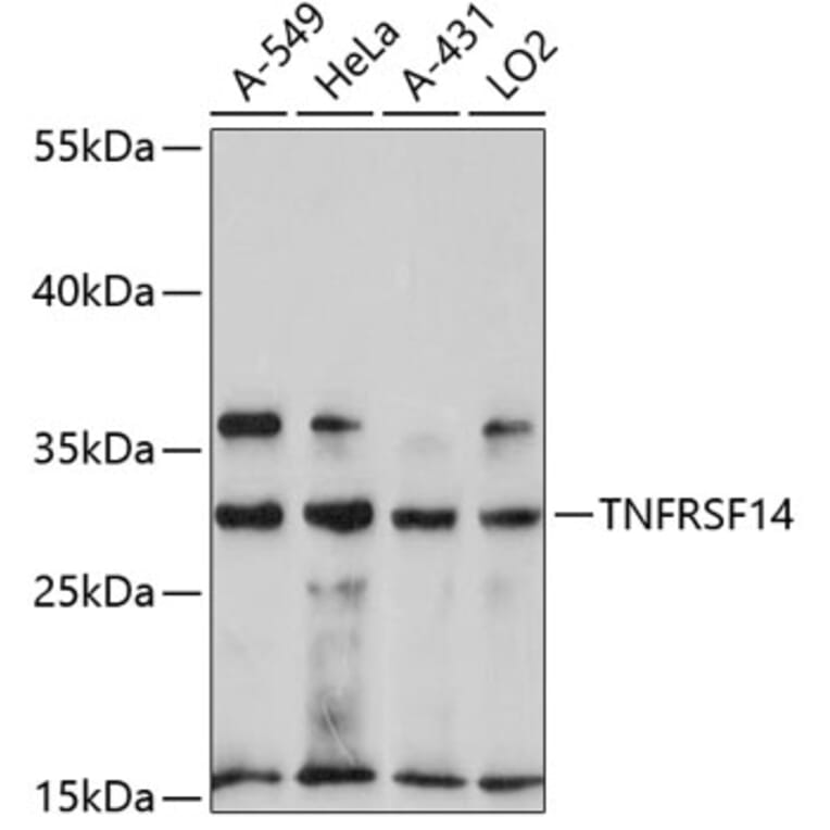 Western Blot - Anti-TNFRSF14 Antibody (A11832) - Antibodies.com