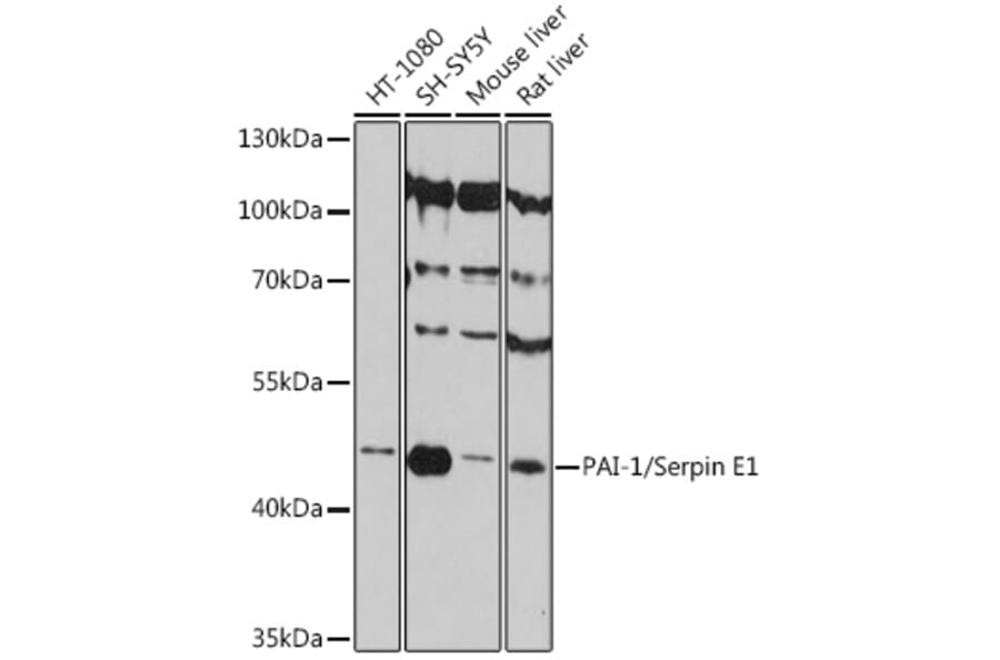 Western Blot - Anti-PAI1 Antibody (A80608) - Antibodies.com