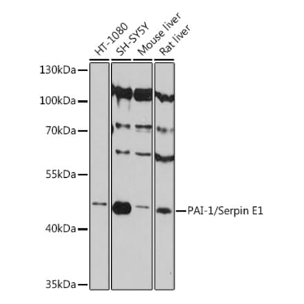 Western Blot - Anti-PAI1 Antibody (A80608) - Antibodies.com