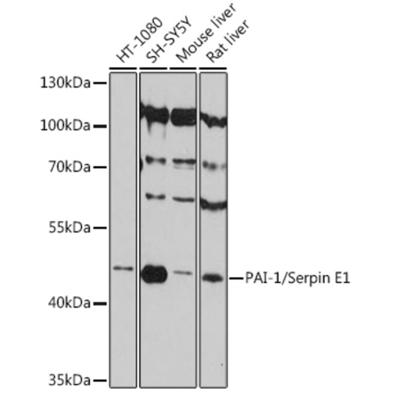 Western Blot - Anti-PAI1 Antibody (A80608) - Antibodies.com