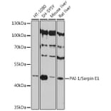Western Blot - Anti-PAI1 Antibody (A80608) - Antibodies.com