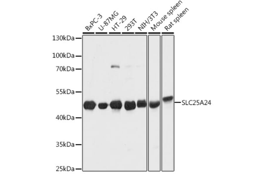 Western Blot - Anti-SLC25A24 Antibody (A80609) - Antibodies.com