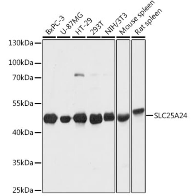 Western Blot - Anti-SLC25A24 Antibody (A80609) - Antibodies.com