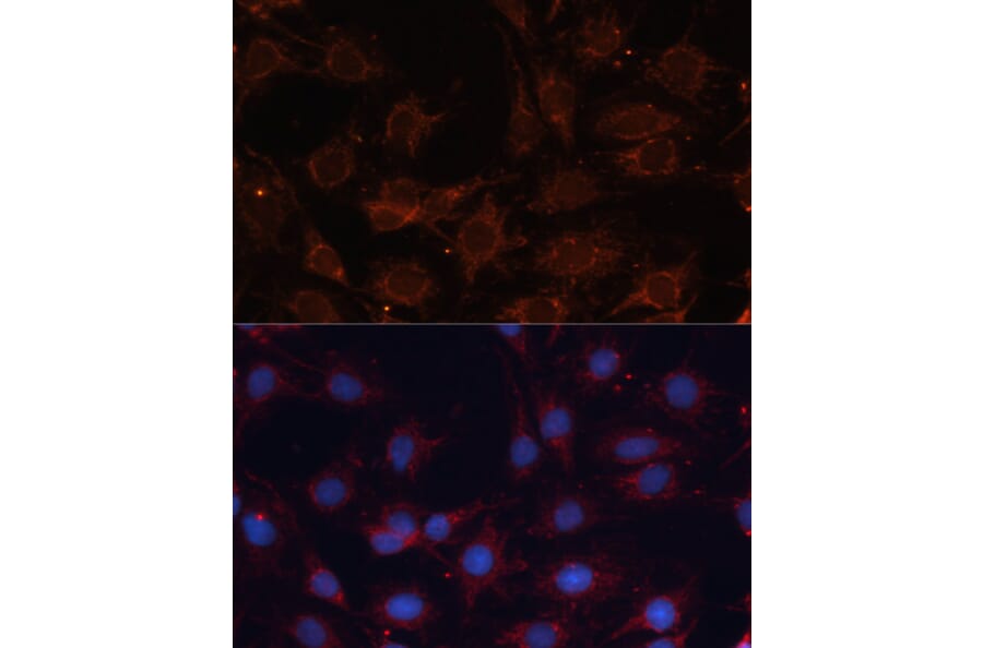 Immunofluorescence - Anti-SLC25A24 Antibody (A80609) - Antibodies.com