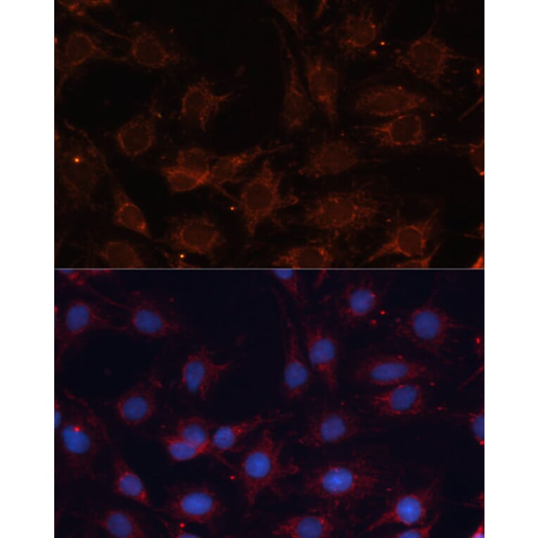 Immunofluorescence - Anti-SLC25A24 Antibody (A80609) - Antibodies.com