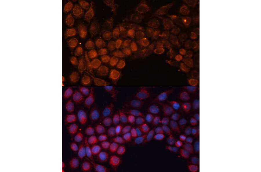 Immunofluorescence - Anti-SLC25A24 Antibody (A80609) - Antibodies.com