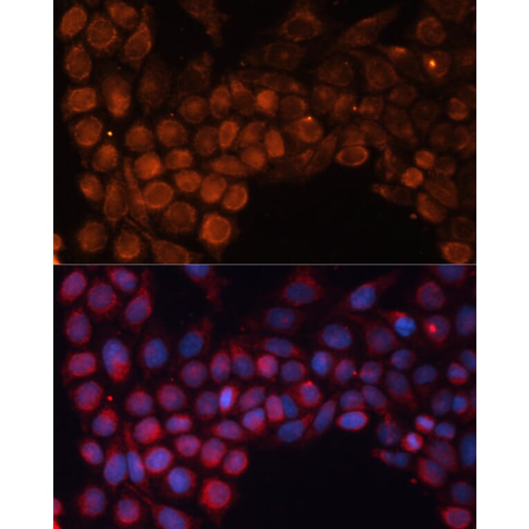 Immunofluorescence - Anti-SLC25A24 Antibody (A80609) - Antibodies.com