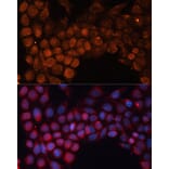 Immunofluorescence - Anti-SLC25A24 Antibody (A80609) - Antibodies.com