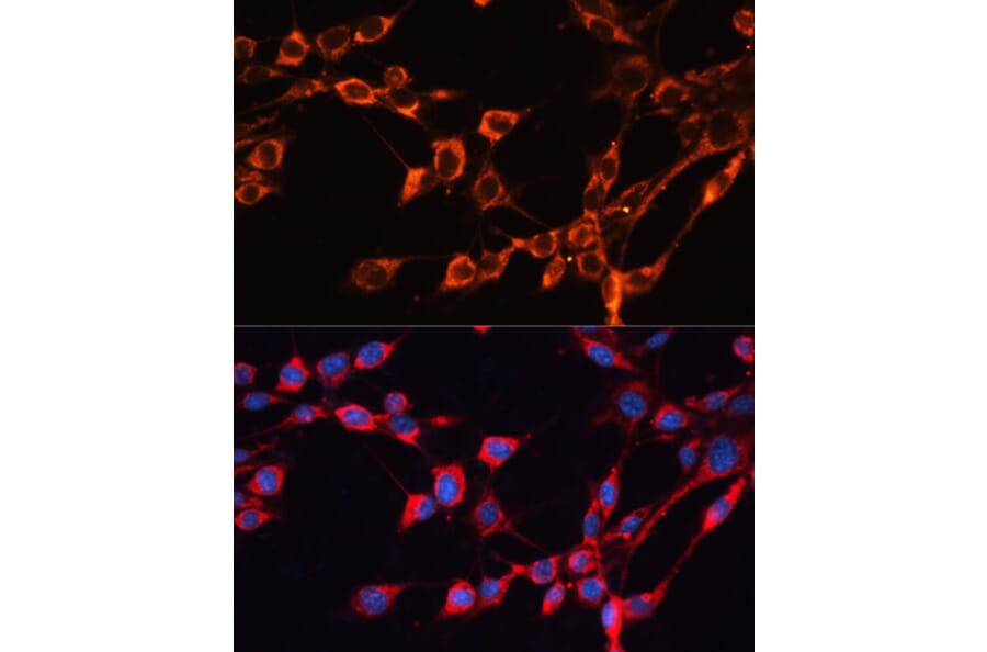 Immunofluorescence - Anti-SLC25A24 Antibody (A80609) - Antibodies.com