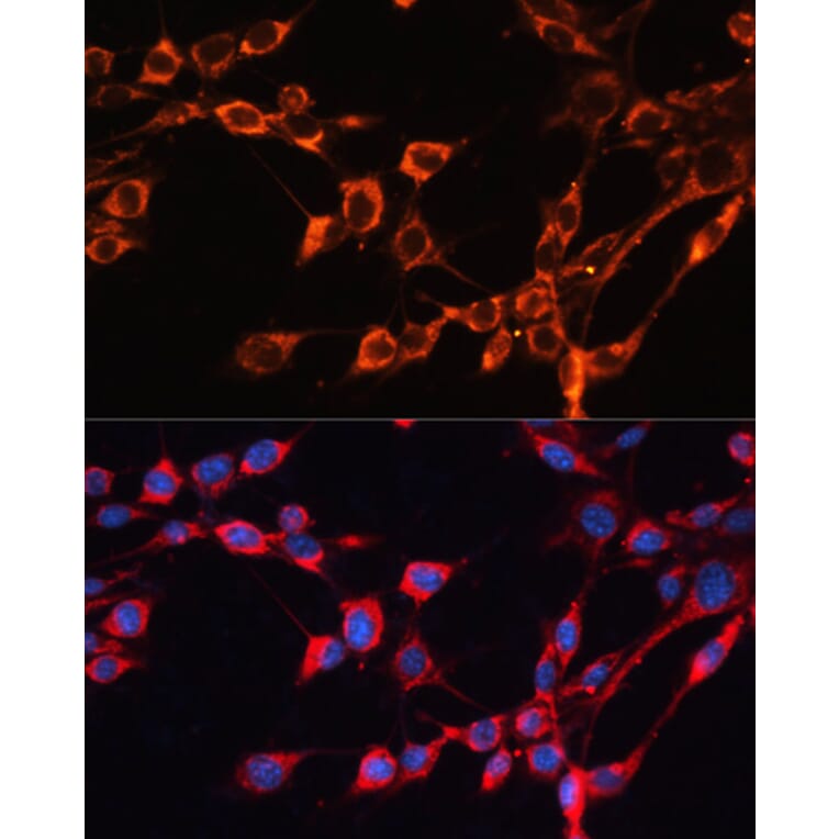 Immunofluorescence - Anti-SLC25A24 Antibody (A80609) - Antibodies.com