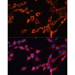 Immunofluorescence - Anti-SLC25A24 Antibody (A80609) - Antibodies.com