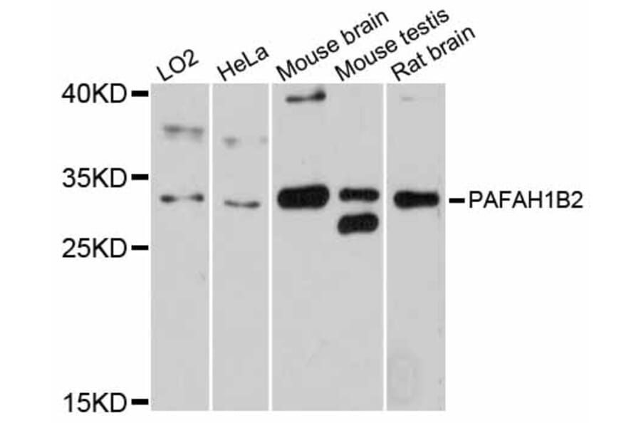 Western Blot - Anti-PAFAH1B2 Antibody (A12170) - Antibodies.com