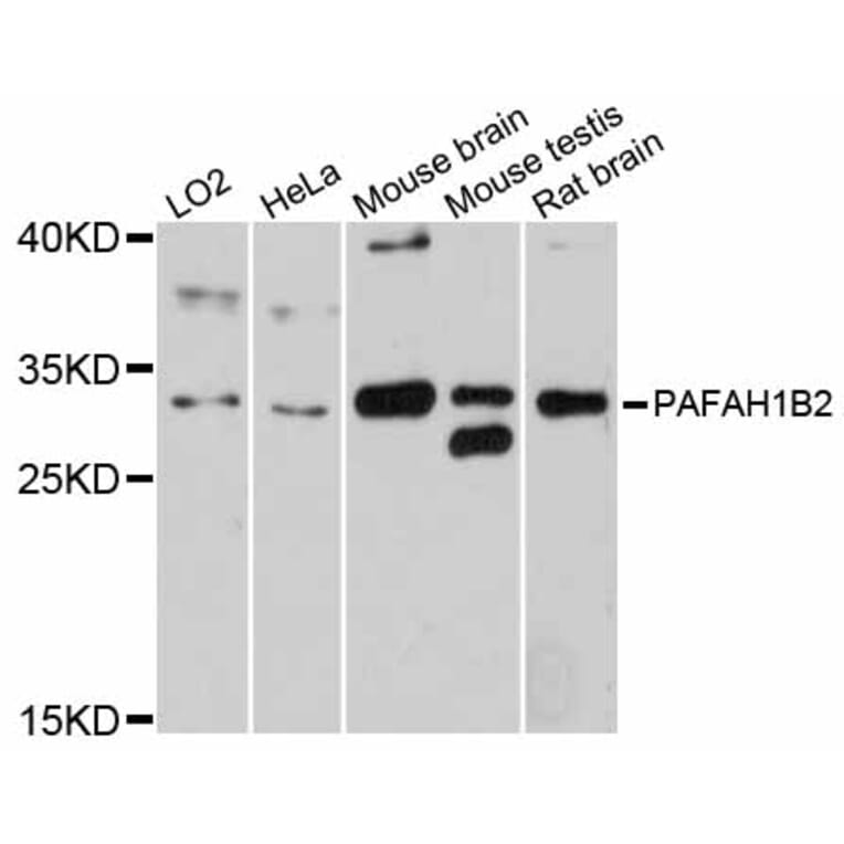Western Blot - Anti-PAFAH1B2 Antibody (A12170) - Antibodies.com