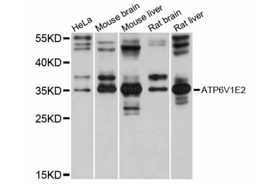 Western Blot - Anti-ATP6V1E2 Antibody (A12204) - Antibodies.com