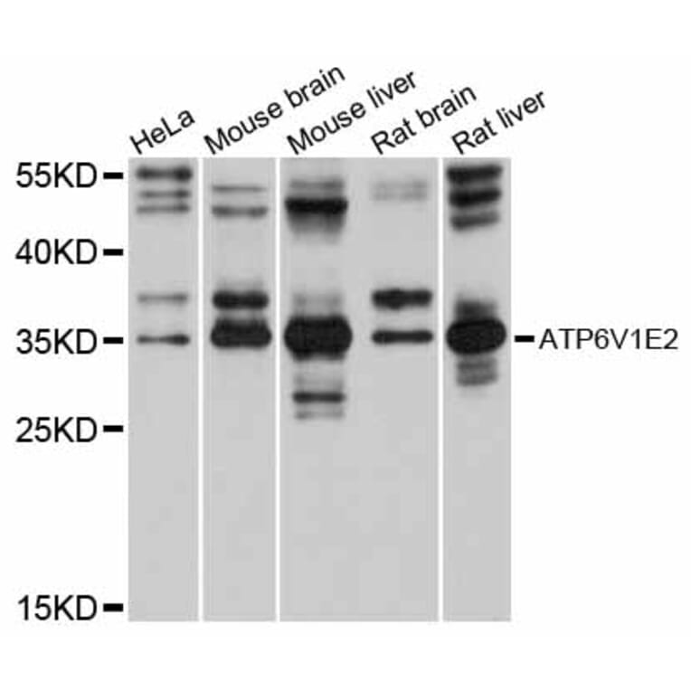 Western Blot - Anti-ATP6V1E2 Antibody (A12204) - Antibodies.com