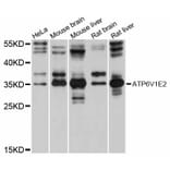 Western Blot - Anti-ATP6V1E2 Antibody (A12204) - Antibodies.com