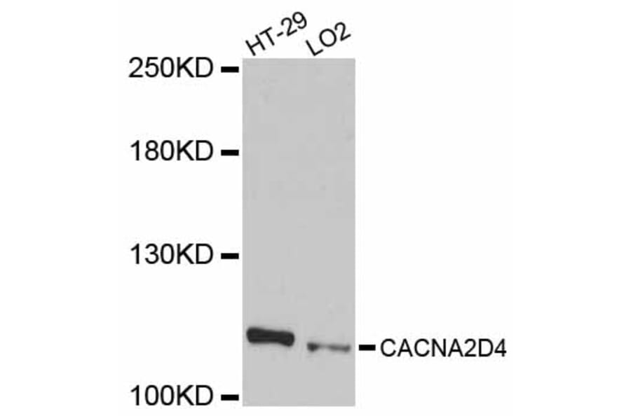 Western Blot - Anti-CACNA2D4 Antibody (A12206) - Antibodies.com
