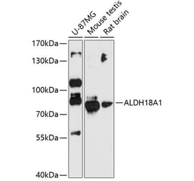 Western Blot - Anti-P5CS Antibody (A80613) - Antibodies.com