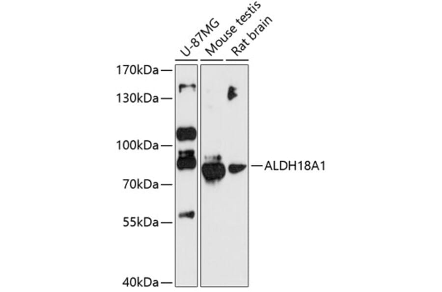 Western Blot - Anti-P5CS Antibody (A80613) - Antibodies.com