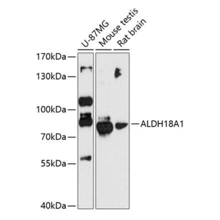Western Blot - Anti-P5CS Antibody (A80613) - Antibodies.com
