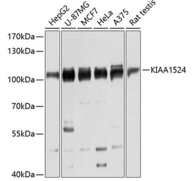 Western Blot - Anti-CIP2A Antibody (A80614) - Antibodies.com