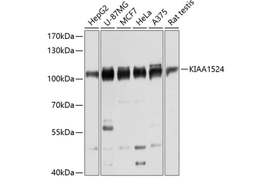 Western Blot - Anti-CIP2A Antibody (A80614) - Antibodies.com