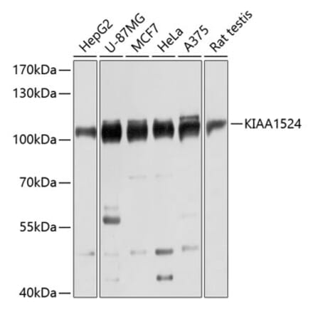 Western Blot - Anti-CIP2A Antibody (A80614) - Antibodies.com