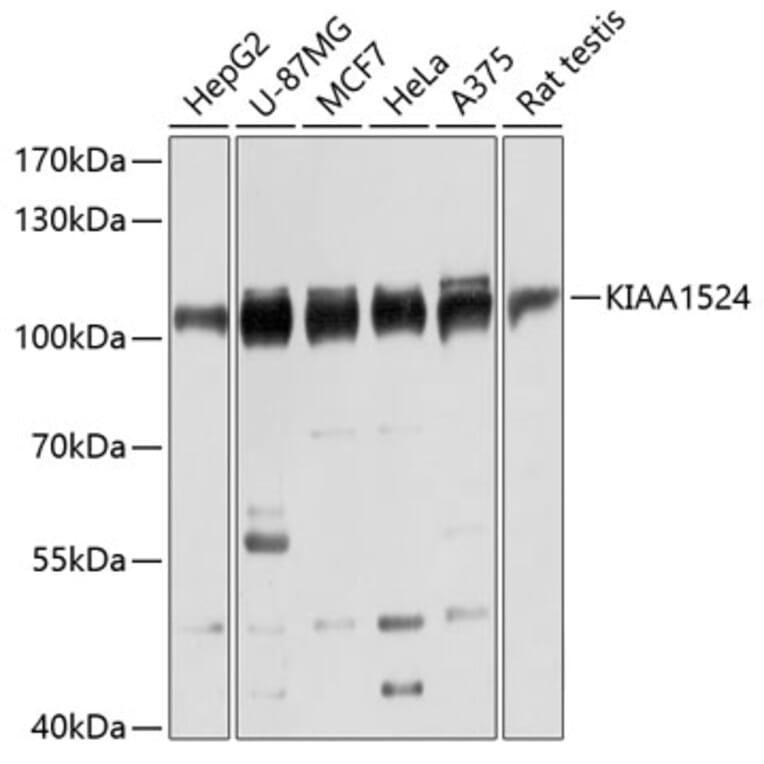 Western Blot - Anti-CIP2A Antibody (A80614) - Antibodies.com