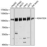 Western Blot - Anti-CIP2A Antibody (A80614) - Antibodies.com