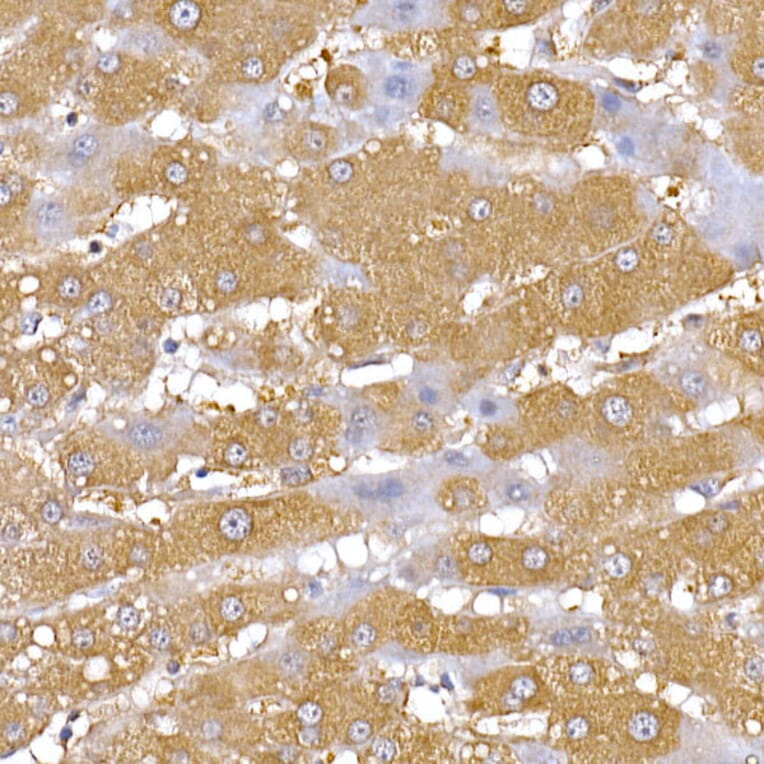 Immunohistochemistry - Anti-PGC1 alpha Antibody (A80615) - Antibodies.com