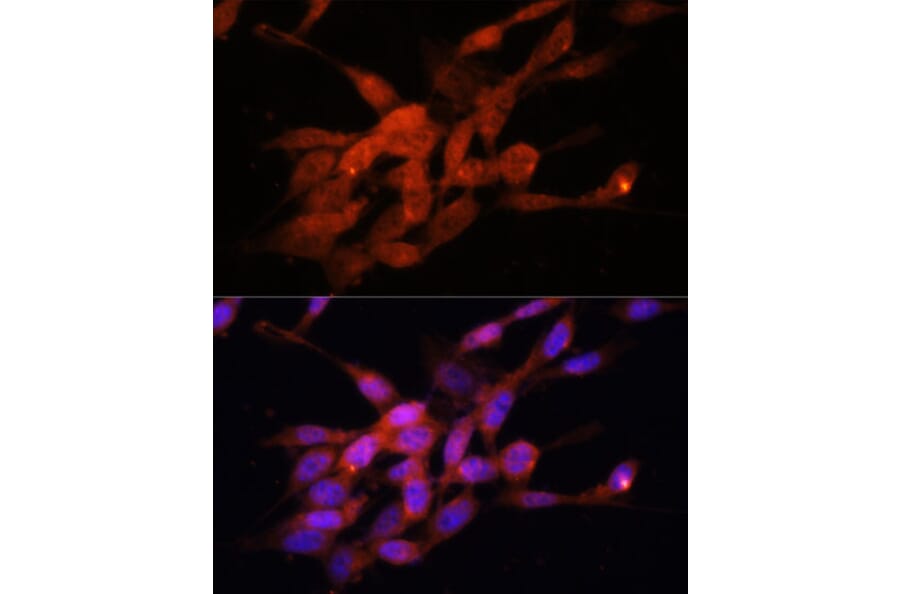 Immunofluorescence - Anti-PGC1 alpha Antibody (A80615) - Antibodies.com